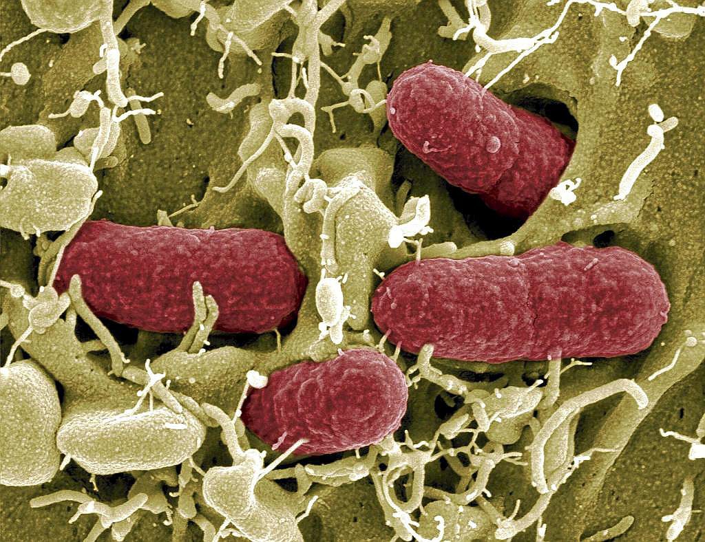 La batalla contra las superbacterias: la amenaza silenciosa que preocupa a la medicina mundial La batalla contra las superbacterias: la amenaza silenciosa que preocupa a la medicina mundial